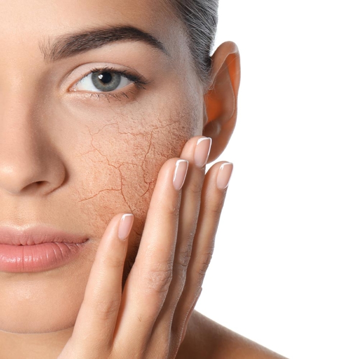 Cum poți să previi deshidratarea pielii în sezonul rece?